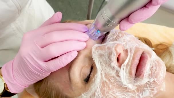 Apparecchiature Frazionarie Radiofrequenza Microneedle Estetista Facendo Rimodellamento Della Pelle Utilizzando — Video Stock