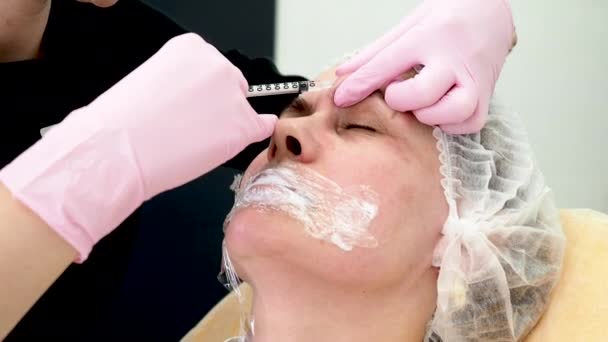 Kosmetologen Punkterar Huden Patientens Ansikte Med Nål — Stockvideo