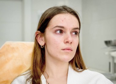 Derisi sorunlu üzgün bir kız kozmetik kliniğinde estetik ameliyatlardan önce koltuğa oturur. Stres ve gerginlik kavramı.