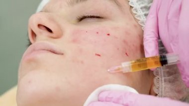 Yakından görmek bir dergi ellerine eldiven içinde bir kadın cilt yüz yaşlanma enjeksiyon yapma. Bir kadın Güzellik yüz kozmetik prosedür alır