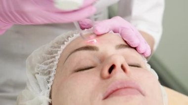 Cilt bakımı kliniğinde lazer tedavisi gören bir kadının makro fotoğrafını çek. Yüzündeki kırışıklıklar, sivilceler ve diğer hasarlar için bir yüzey tekniği. 4K