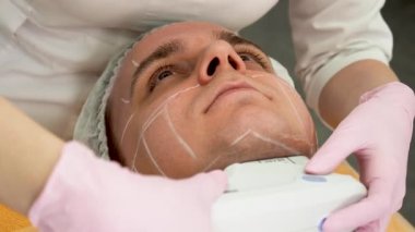 Cerrahi olmayan yüz kaldırma. Smas ultrasoniği kaldırıyor. Yenilenme süreci. Donanım kozmetolojisi. çevre yüz plastiği. 