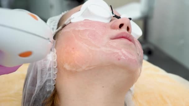 Fototerapia Acne Com Equipamento Profissional Mulher Bonita Salão Beleza Durante — Vídeo de Stock