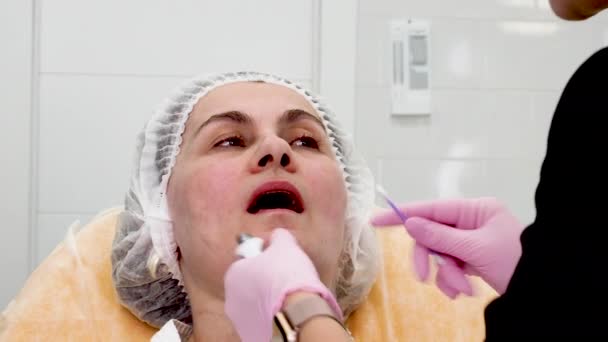 Fecha Médico Aplicando Creme Nos Lábios Femininos Maduros Clínica Cirurgia — Vídeo de Stock