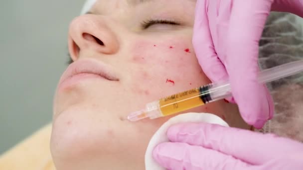 女性の顔の皮膚に複数の注射を作る手袋の医師の美容師の手美容術中に — ストック動画