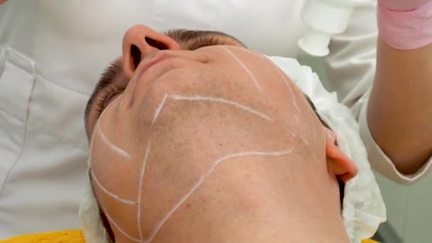 Nicht Chirurgisches Facelifting Smas Hebt Ultraschall Der Prozess Der Verjüngung — Stockvideo