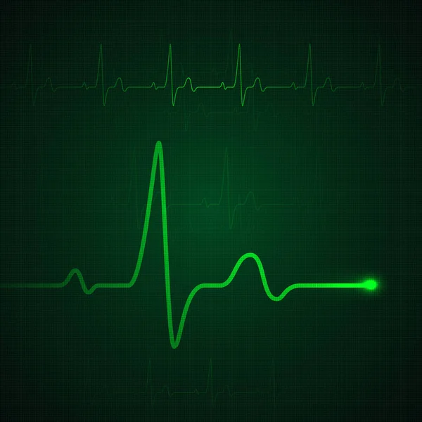 Hartslag op groen display. Hartslaggrafiek of cardiogram. Medicijnmonitoring stresspercentage. Vectorillustratie — Stockvector