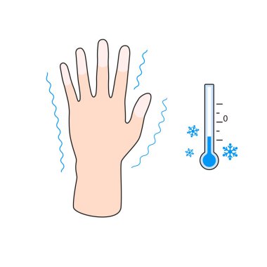 Soğuk ısırığı. Soğuk ısırığı belirtileri gösteren bir el. İnsan parmakları üzerinde soğuk etkisi. Vektör illüstrasyonu