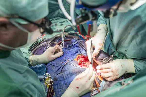 Chirurgiens Exécutant Pontage Cardiaque — Photo