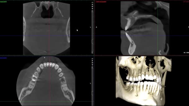 Valós élet MRI vizsgálat ember jaws fogorvos kutatás új minőségű orvostudomány fogászati felvételek animációs képernyő — Stock videók