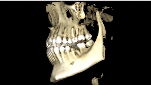 MRI scan van mannenkaken voor stomatologie tandarts onderzoek nieuwe kwaliteit medische wetenschap tandheelkundige beeldmateriaal animatiescherm — Stockvideo