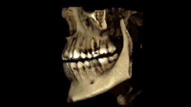 Stomatoloji dişçisi araştırmaları için insan çenesinin gerçek yaşam MRI taraması yeni kaliteli tıbbi bilimler diş görüntüsü canlandırma ekranı