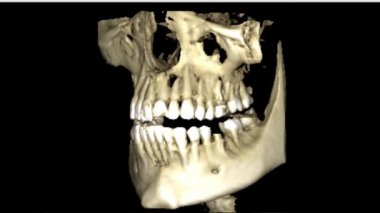 Stomatoloji dişçisi araştırmaları için insan çenesinin gerçek yaşam MRI taraması yeni kaliteli tıbbi bilimler diş görüntüsü canlandırma ekranı