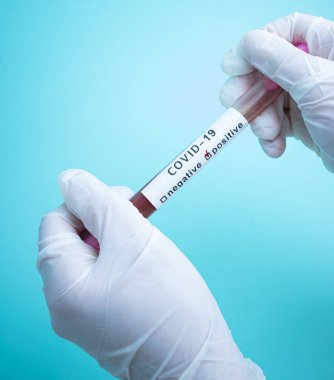 Elinde kan örneği içeren bir test tüpü var. Covid-19 koronavirüs analizi için test tüpü. Laboratuvar test hastaları örneği
