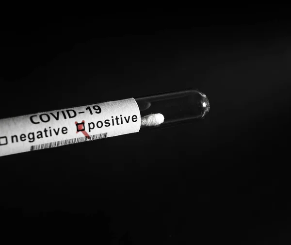 Testbuisjes Met Een Bloedmonster Witte Achtergrond Reageerbuis Voor Covid Coronavirus — Stockfoto