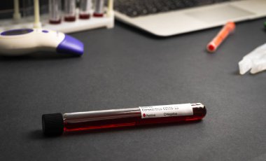 Beyaz arka plan üzerinde kan testi örnekleri içeren test tüpleri, Covid-19 koronavirüs analizi için test tüpleri. Laboratuvar test hastaları örneği 