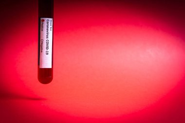Beyaz arka plan üzerinde kan testi örnekleri içeren test tüpleri, Covid-19 koronavirüs analizi için test tüpleri. Laboratuvar hastalarının kırmızı arkaplanda test örnekleri