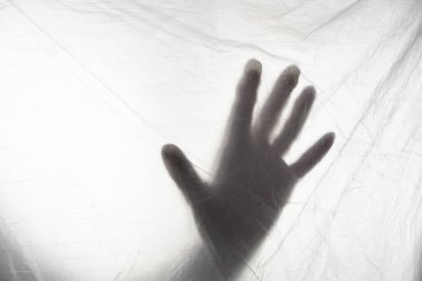 Coronavirus covid 19 numaralı hasta Coronavirus covid 19 numaralı karantina odasında. Hastanedeki karantina odası, Coronavirüs salgını kontrolü.