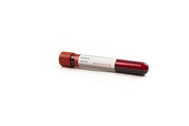 Beyaz arka planda kan testi örneği içeren test tüpü, Covid-19 koronavirüs analizi için test tüpü. Laboratuvar test hastaları örneği