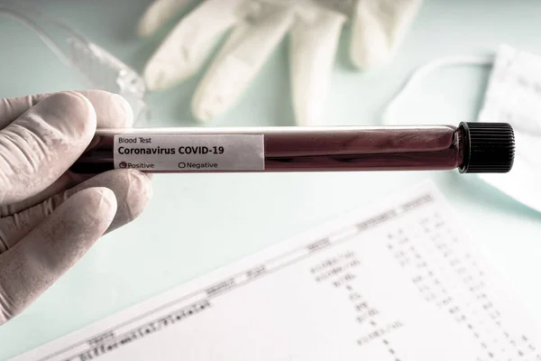 Kézben Egy Vérmintát Tartalmazó Kémcső Van Egy Covid Koronavírus Analizáló — Stock Fotó