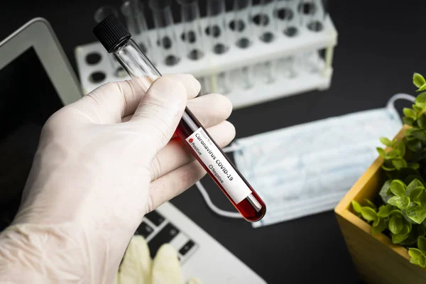 Kézben Egy Vérmintát Tartalmazó Kémcső Van Egy Covid Koronavírus Analizáló — Stock Fotó