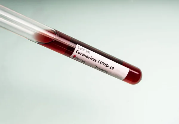 Kan Örneği Içeren Test Tüpü Covid Koronavirüs Için Test Tübü — Stok fotoğraf