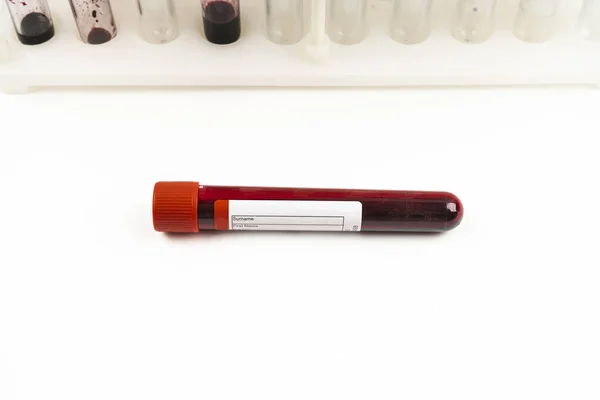 Beyaz Arka Plan Üzerinde Kan Testi Örnekleri Içeren Test Tüpleri — Stok fotoğraf
