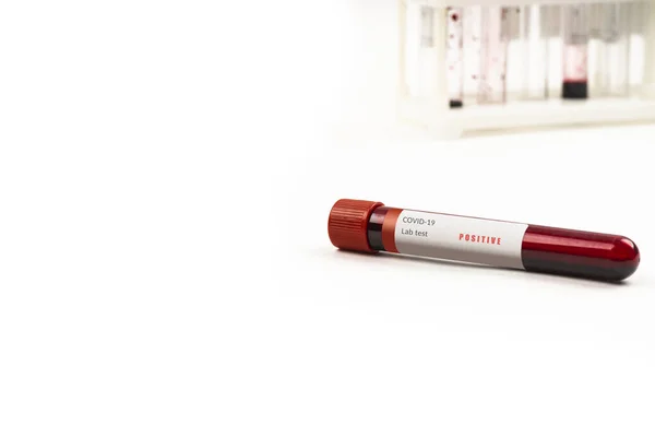 Vérmintákat Tartalmazó Kémcsövek Fehér Háttérrel Covid Koronavírus Analizáló Kémcsővel Laboratóriumi — Stock Fotó