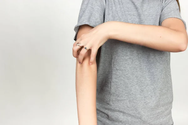 Kız kolunu tırmalamak gri tişörtlü. Uyuz. El scratch