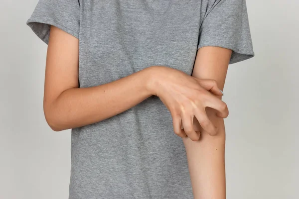 Girl in grey shirt scratching her arm. Scabies. Scratch the hand — Stock Photo, Image