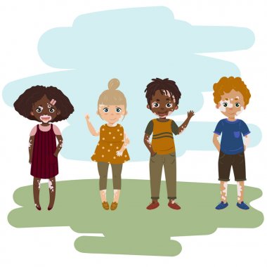 Vitiligo deri hastalığı olan çocuklar