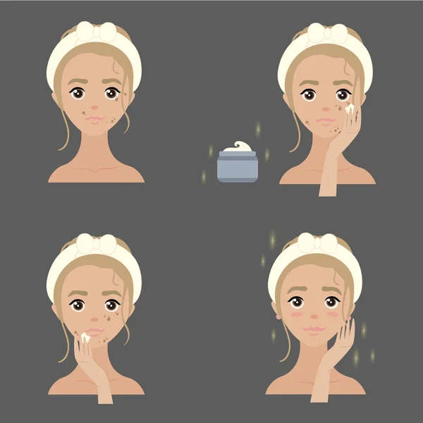 Schritte, wie man Anti-Pigmentierung Gesichtscreme anwendet — Stockvektor