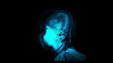 Beyin tomografisi görselleştirmenin sonucudur. İnsan kafası görüntülemesinin dikey slaytları
