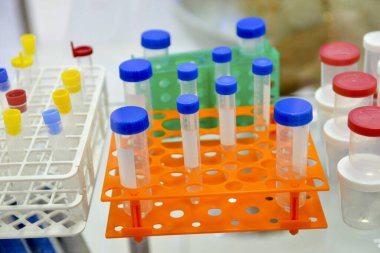 bir bankta plastik Laboratuvar tüpleri