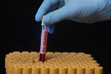 Sağlık uzmanının elinde COVID-19 veya Coronavirüs için kan örneği tüpü var.