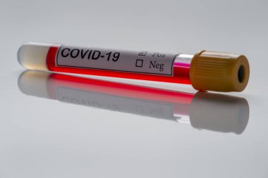 Klinik kan testleri ve covid-19 etiketi için vakum tüpü