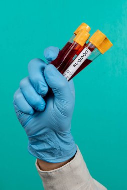 Elinde vakumlu kan tüpü, Covid-19 etiketli.