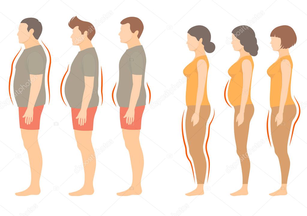 obesity woman and man body type