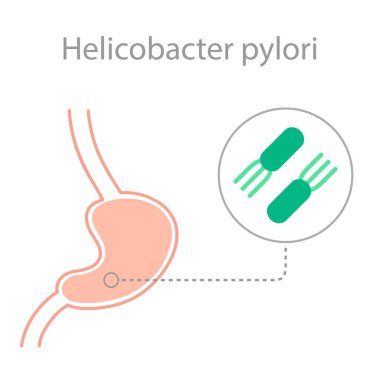 Helicobacter pylori bakteri hastalık