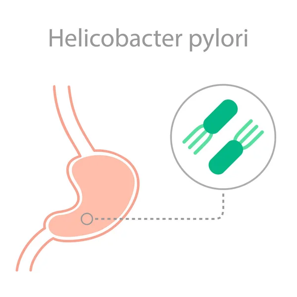 Helicobacter pylori bacteria disease — Stock Vector