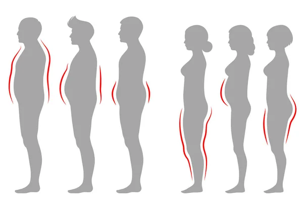 Obezite Kadın Erkek Vücut Tipi Illüstrasyon Vektör Şekil Kilolu Siluet — Stok Vektör