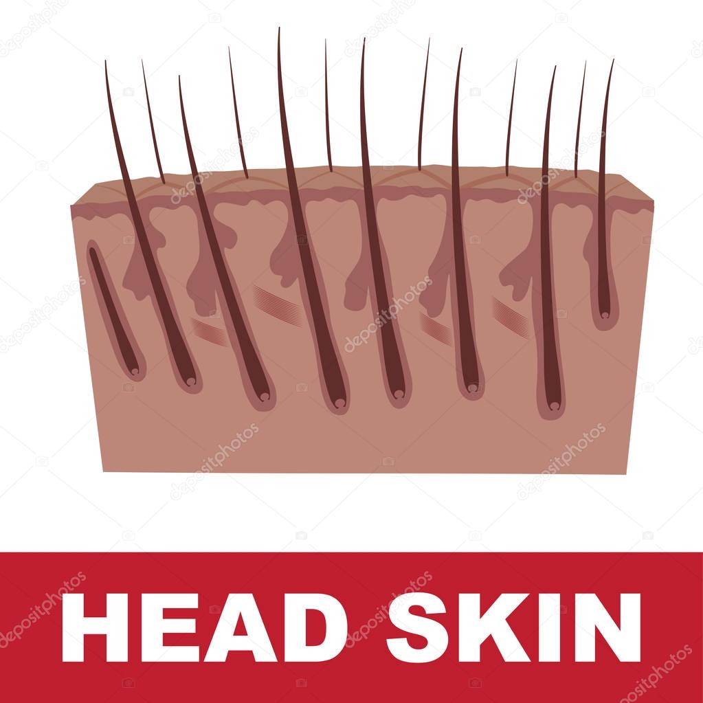 head skin scheme