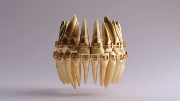 Gouden Tanden Met Tandheelkundige Beugels Illustratie Renderen — Stockfoto