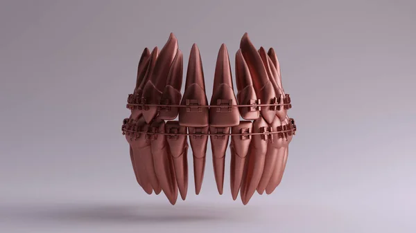 Шоколадні Глиняні Зуби Зубними Брекетами Ілюстрація Рендеринга — стокове фото