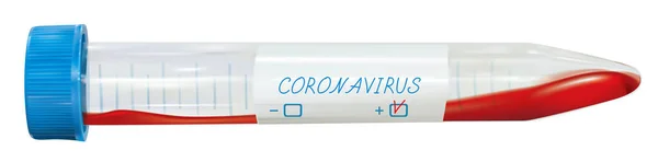 Koronavirüs Üzerinde Kan Testi Mikrobiyolojik Tüp Vektör Illüstrasyonu — Stok Vektör