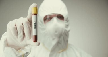 Bilim adamı laboratuvar koruması gözlükleri test tüpü konsepti kuduz kan grisi arka plan