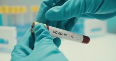 Yakın plan bilim adamı eldivenleri laboratuvar test tüpü korumasını Coronavirus 'a verdi.