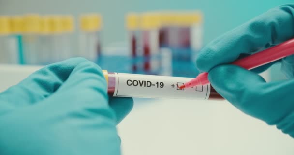 Крупным планом ученый руки написать перчатки лабораторные пробирки защиты коронавируса положительный фон — стоковое видео