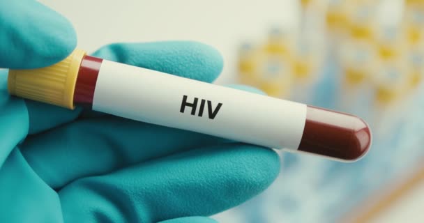 Close-up επιστήμονας χέρια γάντια εργαστηριακή προστασία σωλήνα δοκιμής HIV θετικό υπόβαθρο — Αρχείο Βίντεο