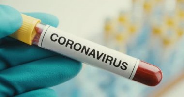 Yakın plan bilim adamı eldivenleri laboratuvar test tüpü korumasını Coronavirus 'a verdi.